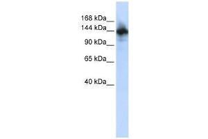 RBM6 antibody used at 2. (RBM6 Antikörper  (N-Term))