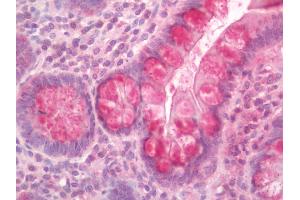 Human Small Intestine: Formalin-Fixed, Paraffin-Embedded (FFPE). (IFNA2 Antikörper  (HRP))