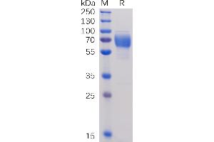 Human 2B4, hFc Tag on SDS-PAGE under reducing condition. (2B4 Protein (AA 22-221) (Fc Tag))