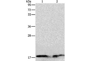 Western blot analysis of Human normal liver and fetal liver tissue, using ANG Polyclonal Antibody at dilution of 1:133 (ANG Antikörper)