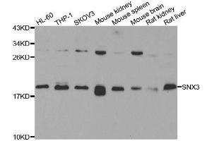 Western blot analysis of extracts of various cell lines, using SNX3 antibody. (Sorting Nexin 3 Antikörper  (AA 1-162))