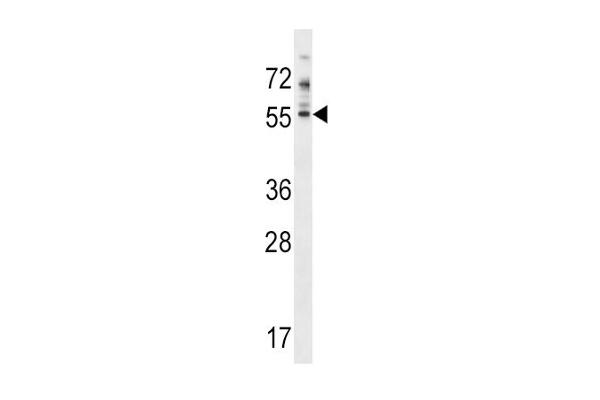 PDE7A Antikörper  (N-Term)