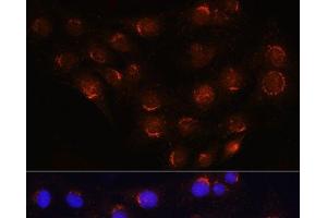 Immunofluorescence analysis of C6 cells using GOLGA4 Polyclonal Antibody at dilution of 1:100 (40x lens). (GOLGA4 Antikörper)