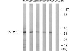 Western blot analysis of extracts from HeLa cells, COLO cells, HT-29 cells, HepG2 cells and HUVEC cells, using P2RY13 antibody. (Purinergic Receptor P2Y, G-Protein Coupled, 13 (P2RY13) (Internal Region) Antikörper)