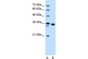 Western Blotting (WB) image for anti-Aldo-Keto Reductase Family 1, Member B1 (Aldose Reductase) (AKR1B1) antibody (ABIN2463149) (AKR1B1 Antikörper)
