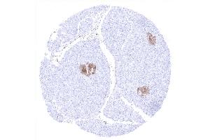 Positive NSE immunostaining of islets of Langerhans (ENO2/NSE Antikörper  (AA 416-433))