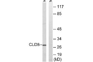 Western blot analysis of extracts from Jurkat cells, using CLDN8 antibody. (CLDN8 Antikörper)
