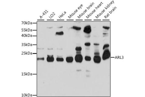 ARL3 Antikörper  (AA 1-182)