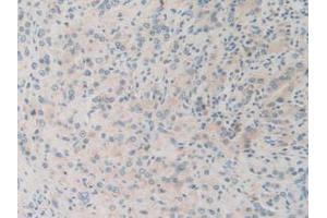 IHC-P analysis of Human Prostate Gland Tissue, with DAB staining. (SQSTM1 Antikörper  (AA 136-400))