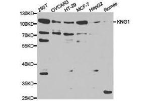 Western Blotting (WB) image for anti-Kininogen 1 (KNG1) antibody (ABIN1873454) (KNG1 Antikörper)