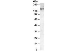 Western blot testing of A549 lysate with ABCC1 antibody at 0. (ABCC1 Antikörper)