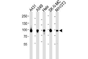 Western blot analysis of lysates from A431, A549, Hela, SK-N-MC, mouse NIH/3T3 cell line (from left to right), using HSP90 Antibody (Center) (ABIN6243458 and ABIN6577427). (HSP90 Antikörper  (AA 299-331))