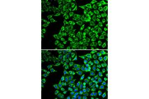 Immunofluorescence analysis of A549 cells using LIPC antibody. (LIPC Antikörper)