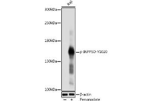 Western blot analysis of extracts of Raji cells, using Phospho-SHIP1-Y1020 antibody (ABIN6135243, ABIN6136110, ABIN6136111 and ABIN6225677) at 1:1000 dilution. (INPP5D Antikörper  (pTyr1020))