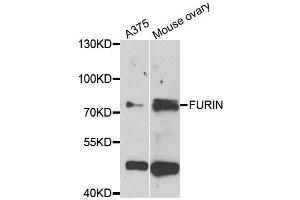Western blot analysis of extracts of A375 and mouse ovary cell lines, using FURIN antibody. (FURIN Antikörper)