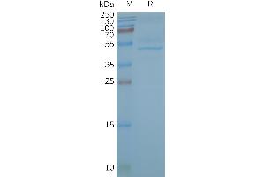 Human CB2-Nanodisc, Flag Tag on SDS-PAGE (CNR2 Protein)
