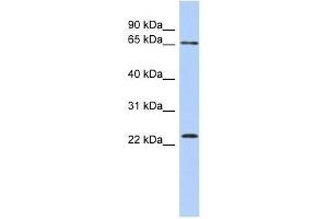 ZNF428 antibody used at 0. (ZNF428 Antikörper  (N-Term))