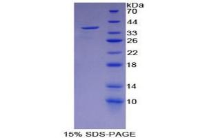 SDS-PAGE analysis of Mouse ENO2 Protein. (ENO2/NSE Protein)