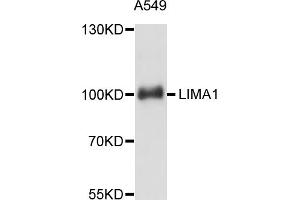 Western blot analysis of extracts of A-549 cells, using LIMA1 antibody. (LIMA1 Antikörper)