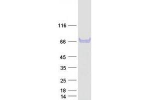 Validation with Western Blot (Aspartate beta Hydroxylase Protein (Transcript Variant 2) (Myc-DYKDDDDK Tag))