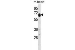 Western Blotting (WB) image for anti-Recombination Activating Gene 2 (RAG2) antibody (ABIN5978584) (RAG2 Antikörper)