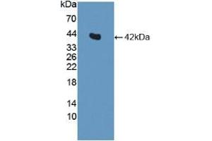 Figure. (Insulin Antikörper  (AA 25-110))