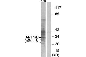 Immunohistochemistry analysis of paraffin-embedded human skeletal muscle tissue, using AMPK β1 (Phospho-Ser181) antibody. (PRKAB1 Antikörper  (pSer181))