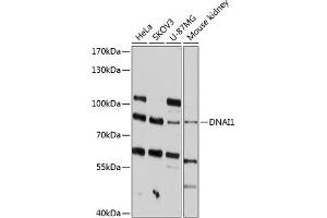 Western blot analysis of extracts of various cell lines, using DN antibody (ABIN6129798, ABIN6139690, ABIN6139691 and ABIN6215711) at 1:1000 dilution. (DNAI1 Antikörper  (AA 350-699))