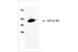 Antigen: GST-LCN2 (ABIN2703637) full length recombinant protein 2 ng  Primary Antibody: Anti-LCN2 monoclonal (PA348-26. (Lipocalin 2 Antikörper)