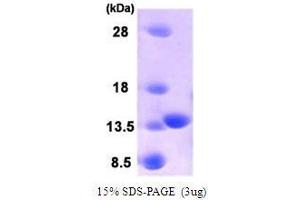 Figure annotation denotes ug of protein loaded and % gel used. (PLA2G16 Protein (AA 1-133))