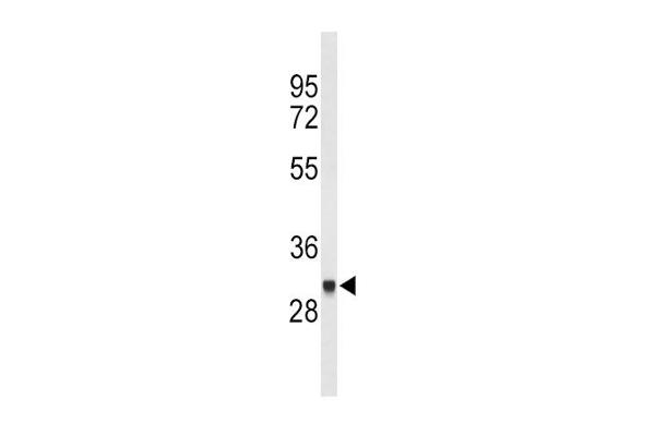 FCGR1B Antikörper  (C-Term)