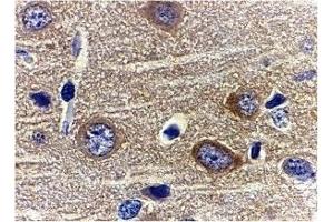 Immunohistochemistry (IHC) image for anti-Adiponectin (ADIPOQ) (N-Term) antibody (ABIN1031215) (ADIPOQ Antikörper  (N-Term))