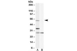 Western blot testing of HeLa cell lysate with PRPF31 antibody at 1ug/ml with [B] and without [A] blocking/immunizing peptide. (PRPF31 Antikörper)