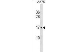 Western Blotting (WB) image for anti-Signal Recognition Particle 14kDa (Homologous Alu RNA Binding Protein) (SRP14) antibody (ABIN3000684) (SRP14 Antikörper)