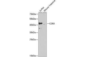 Western blot analysis of extracts of various cell lines, using CD83 antibody (ABIN3022765, ABIN3022766, ABIN3022767 and ABIN6219216) at 1:1000 dilution. (CD83 Antikörper  (AA 20-144))