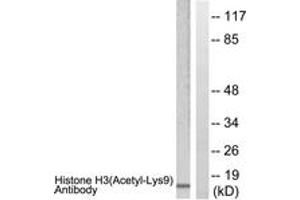 Western Blotting (WB) image for anti-Histone 3 (H3) (H3K9ac) antibody (ABIN2890729) (Histone 3 Antikörper  (H3K9ac))