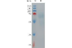 Human IL12A & IL12B Heterodimer Protein, hFc Tag & His Tag on SDS-PAGE under reducing condition. (IL12 Protein (AA 23-219) (Fc-His Tag))