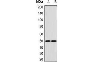 Western blot analysis of Ephrin B2 expression in mouse lung (A), mouse brain (B) whole cell lysates. (Ephrin B2 Antikörper)