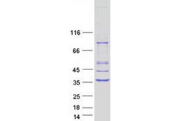 PYCR1 Protein (Transcript Variant 1) (Myc-DYKDDDDK Tag)