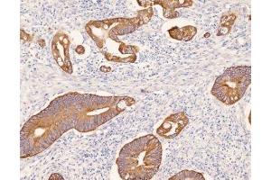 Immunohistochemistry (IHC) image for anti-Keratin 8 (KRT8) (C-Term) antibody (ABIN870549) (KRT8 Antikörper  (C-Term))