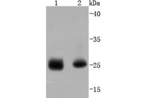 Lane 1: Human heart, Lane 2: Human skeletal muscle lysate probed with PI 3 Kinase p85 alpha (2G4) Monoclonal Antibody  at 1:1000 overnight at 4˚C. (HSP27 Antikörper  (pSer78))