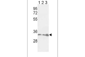 Western blot analysis of PCNA Antibody in Jurkat(lane 1), Hela(lane 2), 293(lane 3) cell line lysates (35ug/lane) (PCNA Antikörper  (AA 89-117))