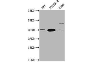 Western Blot Positive WB detected in: U87 whole cell lysate, NTERA-2 whole cell lysate, K562 whole cell lysate All lanes: CBY1 antibody at 1:2000 Secondary Goat polyclonal to rabbit IgG at 1/50000 dilution Predicted band size: 15 kDa Observed band size: 35 kDa (CBY1/PGEA1 Antikörper  (AA 41-126))