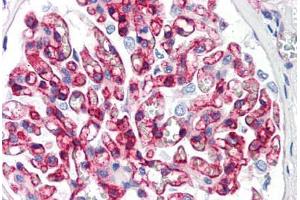 Human Kidney (formalin-fixed, paraffin-embedded) stained with B2M antibody ABIN292915 at 10 ug/ml followed by biotinylated anti-mouse IgG secondary antibody ABIN481714, alkaline phosphatase-streptavidin and chromogen. (beta-2 Microglobulin Antikörper)