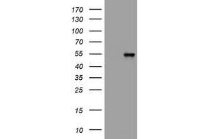 Image no. 6 for anti-Vimentin (VIM) antibody (ABIN1501716) (Vimentin Antikörper)