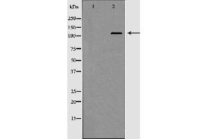 Western blot analysis of HDAC5 expression in HepG2 cell extract. (HDAC5 Antikörper  (C-Term))