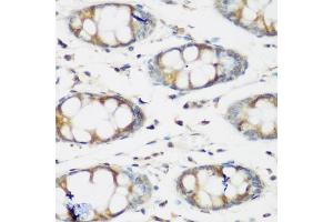 Immunohistochemistry of paraffin-embedded human colon using BMP2 antibody. (BMP2 Antikörper)