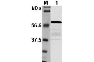 Western blot analysis using anti-Listeria sp. (Listerien Monocytogenes, P60 Antikörper)