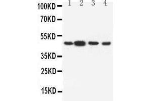 Anti-Dopamine Receptor D3 antibody, Western blotting Lane 1: Rat Testis Tissue Lysate Lane 2: Rat Brain Tissue Lysate Lane 3: U87 Cell Lysate Lane 4: HELA Cell Lysate (DRD3 Antikörper  (C-Term))