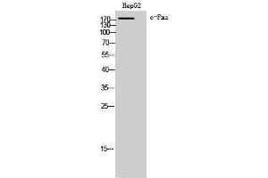 Western Blotting (WB) image for anti-Colony Stimulating Factor 1 Receptor (CSF1R) (Ser275) antibody (ABIN3174363) (CSF1R Antikörper  (Ser275))